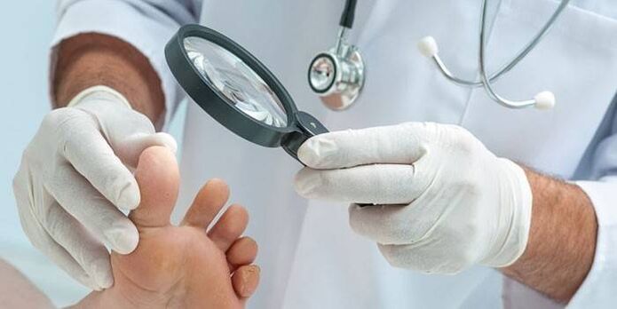 The doctor examines a patient's foot with a toe with a magnifying glass