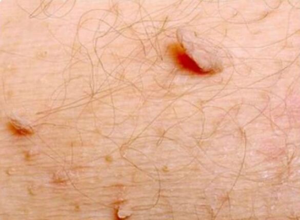 Shapes sharpened on the human body