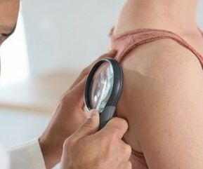 How to determine the human papilloma virus